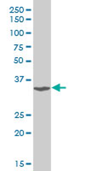 TSC22D3 polyclonal antibody (A01)