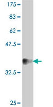 DSCAM polyclonal antibody (A01)