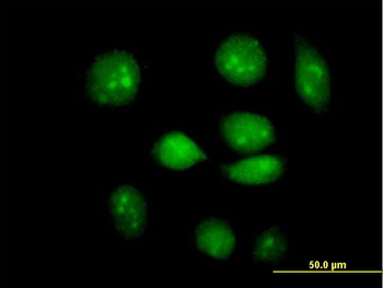 ARID3A purified MaxPab mouse polyclonal antibody (B01P)