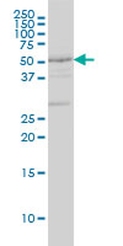 DRD2 monoclonal antibody (M01A), clone 1B11