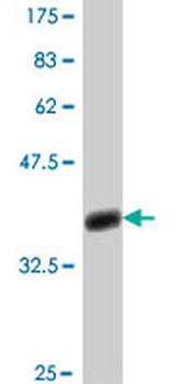 SLC26A3 polyclonal antibody (A01)