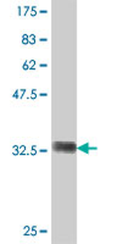 DPYS polyclonal antibody (A01)
