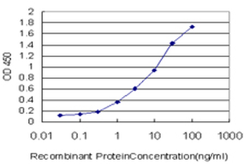 DPYD monoclonal antibody (M01), clone 7D4