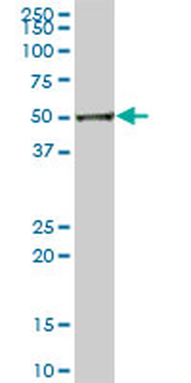 DPH2 MaxPab mouse polyclonal antibody (B01P)