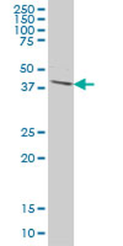 DPH1 monoclonal antibody (M02), clone 2C5