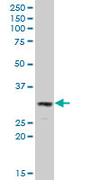 DNASE2 polyclonal antibody (A01)