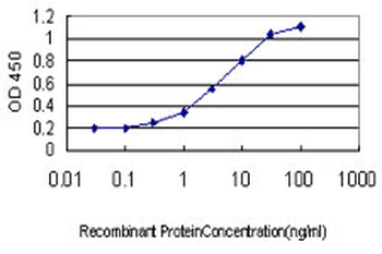 DMRT1 monoclonal antibody (M01), clone 1G11