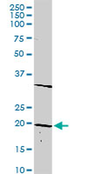 DLX6 purified MaxPab rabbit polyclonal antibody (D01P)