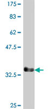DLX6 polyclonal antibody (A01)