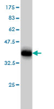DLX4 monoclonal antibody (M01), clone 1F11
