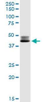 DLST MaxPab rabbit polyclonal antibody (D01)