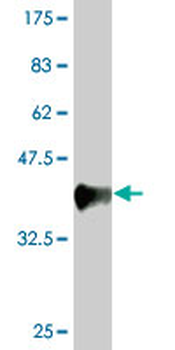 DLG1 monoclonal antibody (M03), clone 1B12