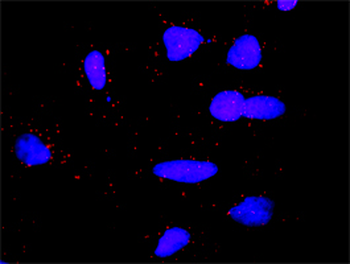 DLG1 monoclonal antibody (M01), clone 1D8