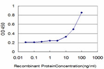 DLD monoclonal antibody (M05), clone 2D4