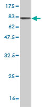 DLD monoclonal antibody (M02), clone 3C1