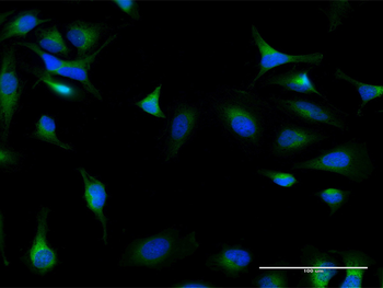 DIAPH1 purified MaxPab mouse polyclonal antibody (B02P)
