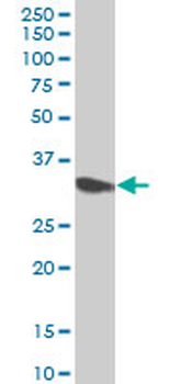 CYB5R3 polyclonal antibody (A01)