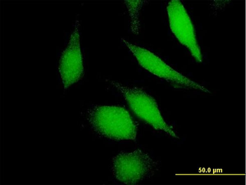 DHFR MaxPab mouse polyclonal antibody (B01)