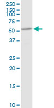 DHCR7 purified MaxPab rabbit polyclonal antibody (D01P)