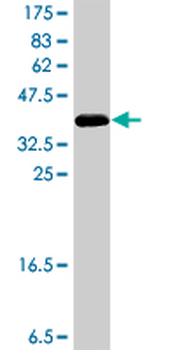 DECR1 polyclonal antibody (A01)