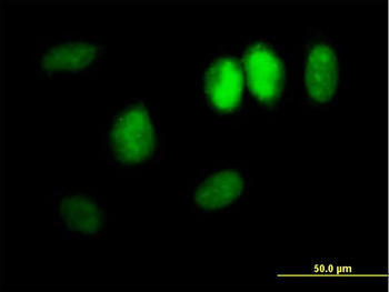DDX11 MaxPab mouse polyclonal antibody (B01)