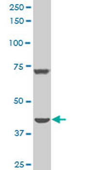 DDX11 polyclonal antibody (A01)