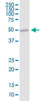 DDOST monoclonal antibody (M06), clone 2D7