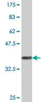 DDOST polyclonal antibody (A01)