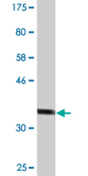 DDB2 monoclonal antibody (M01), clone 1F11