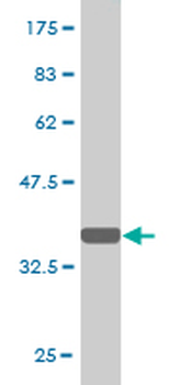 DDB1 monoclonal antibody (M01), clone 4C5