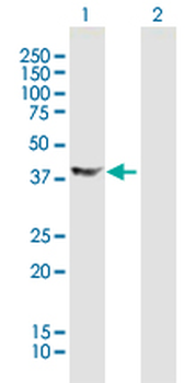 DCX purified MaxPab mouse polyclonal antibody (B01P)