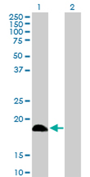 DCTD purified MaxPab rabbit polyclonal antibody (D01P)