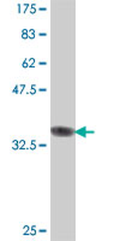 DCTD polyclonal antibody (A01)