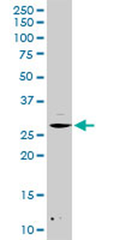 DCK MaxPab rabbit polyclonal antibody (D03)
