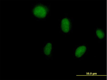 DCK purified MaxPab mouse polyclonal antibody (B01P)