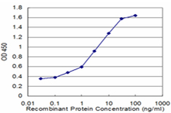 DBN1 monoclonal antibody (M03), clone 2E11