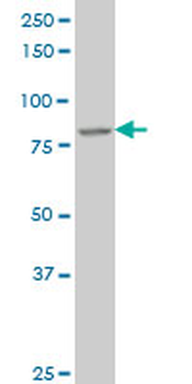 DAZ1 monoclonal antibody (M01), clone 3G10