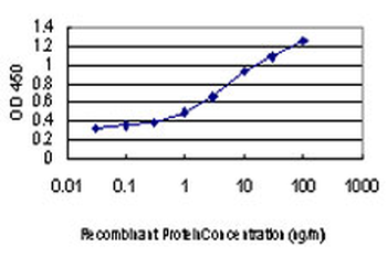 DAPK1 monoclonal antibody (M01), clone 2E7