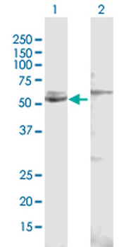CYP51A1 purified MaxPab rabbit polyclonal antibody (D01P)