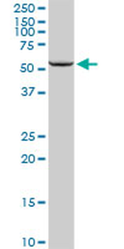 CYP11A1 purified MaxPab rabbit polyclonal antibody (D01P)