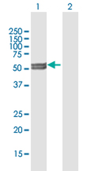 CYP11A1 purified MaxPab mouse polyclonal antibody (B01P)