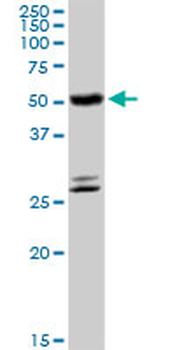 CYP4B1 MaxPab rabbit polyclonal antibody (D01)