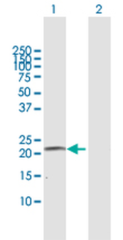 CYP4A11 purified MaxPab mouse polyclonal antibody (B01P)
