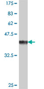 CYP2F1 polyclonal antibody (A01)