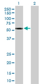 CYP2A13 purified MaxPab rabbit polyclonal antibody (D01P)
