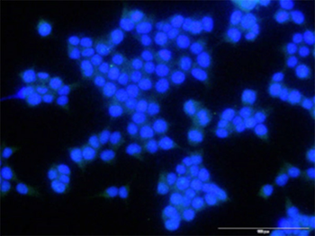 CX3CR1 purified MaxPab mouse polyclonal antibody (B01P)