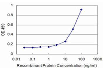 CTSK monoclonal antibody (M01), clone 2F1