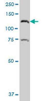 CTNND2 polyclonal antibody (A01)