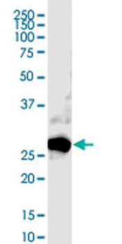 CTLA4 monoclonal antibody (M37), clone 5G6