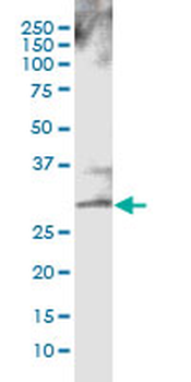 CTLA4 monoclonal antibody (M33), clone 8D7